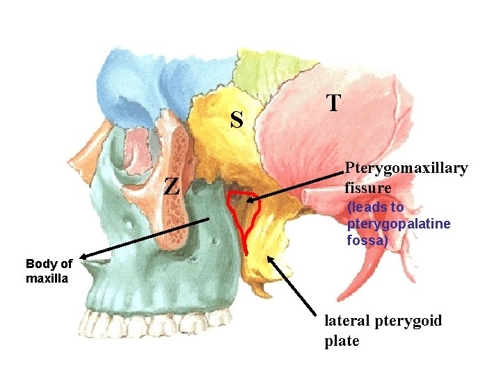 S Z T Pterygomaxillary fissure (leads to pterygopalatine fossa) Body of maxilla lateral pterygoid