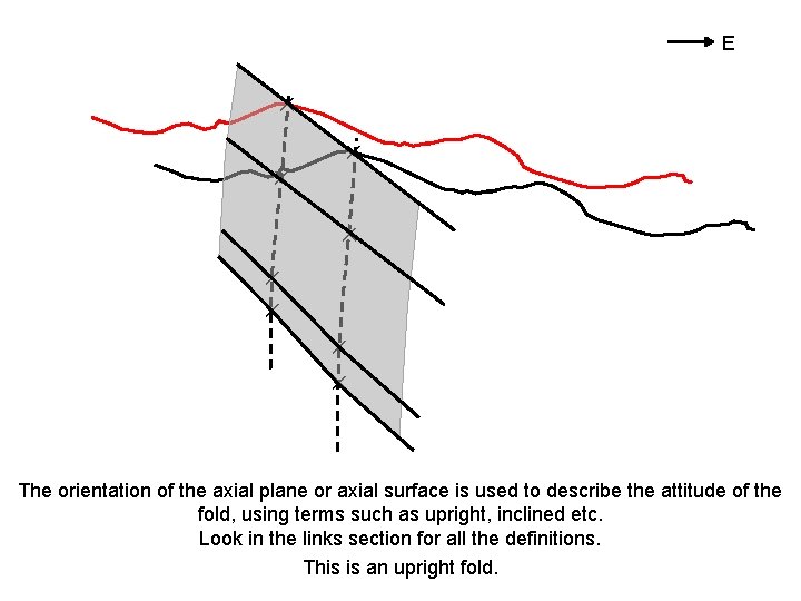 E ✕ ✕ ✕ ✕ The orientation of the axial plane or axial surface