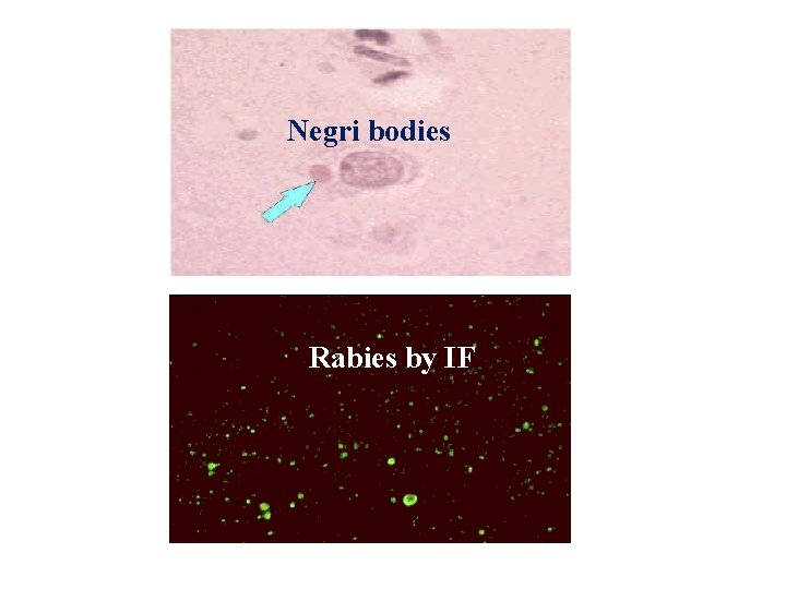 Negri bodies Rabies by IF 