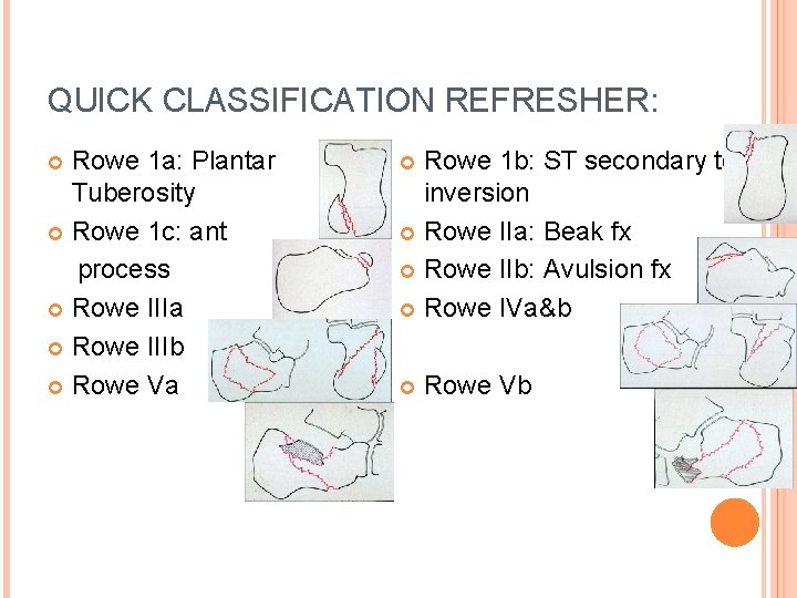 QUICK CLASSIFICATION REFRESHER: Rowe 1 a: Plantar Tuberosity Rowe 1 c: ant process Rowe