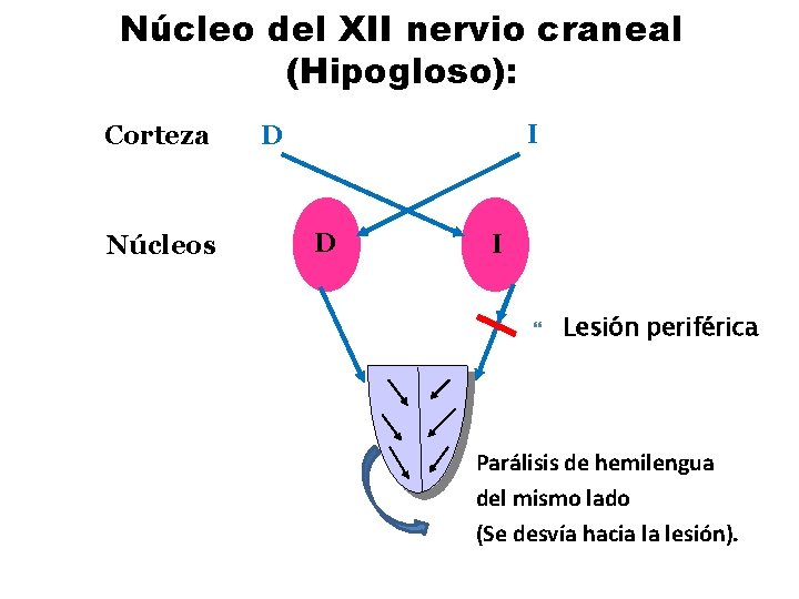 Núcleo del XII nervio craneal (Hipogloso): Corteza Núcleos I D D I Lesión periférica