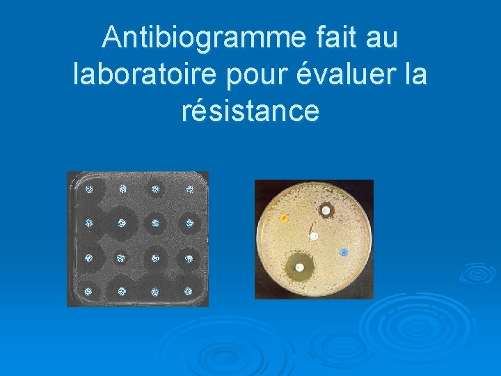 Antibiogramme fait au laboratoire pour évaluer la résistance 
