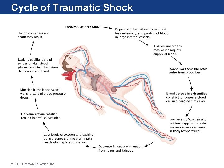 Cycle of Traumatic Shock © 2012 Pearson Education, Inc. 