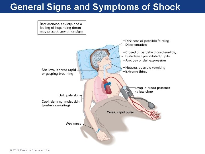 General Signs and Symptoms of Shock © 2012 Pearson Education, Inc. 
