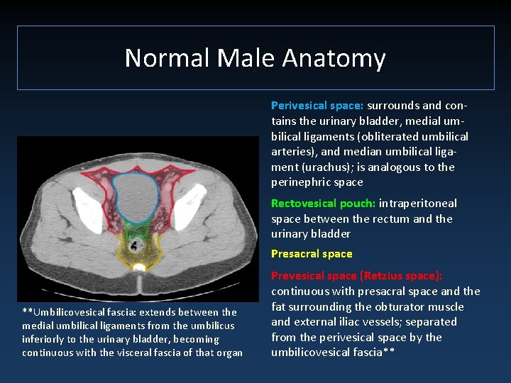 Normal Male Anatomy Perivesical space: surrounds and contains the urinary bladder, medial umbilical ligaments