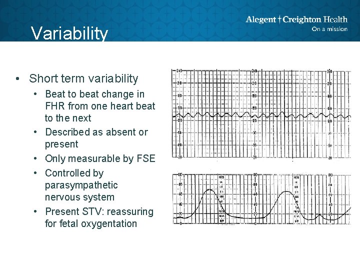 Variability • Short term variability • Beat to beat change in FHR from one