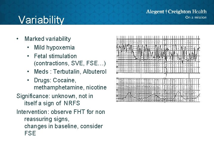 Variability • Marked variability • Mild hypoxemia • Fetal stimulation (contractions, SVE, FSE…) •