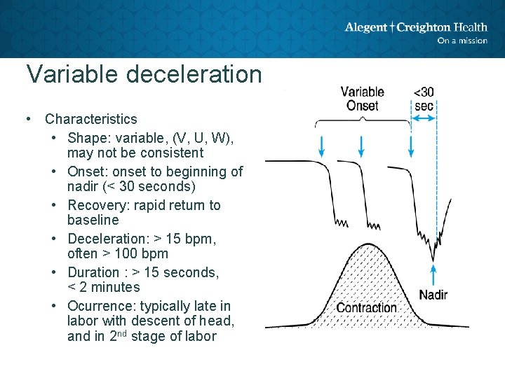 Variable deceleration • Characteristics • Shape: variable, (V, U, W), may not be consistent