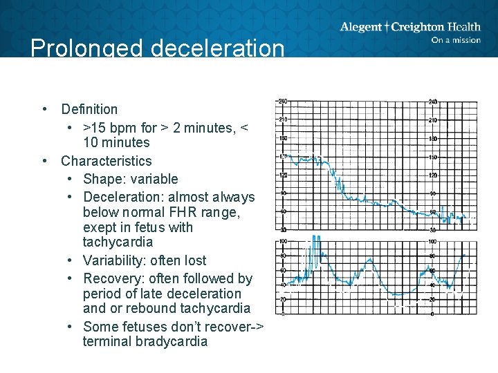 Prolonged deceleration • Definition • >15 bpm for > 2 minutes, < 10 minutes