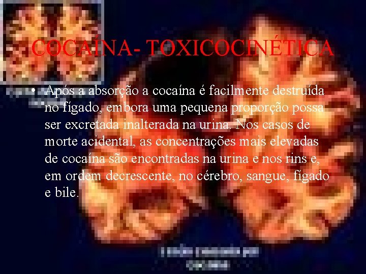 COCAÍNA- TOXICOCINÉTICA • Após a absorção a cocaína é facilmente destruída no fígado, embora
