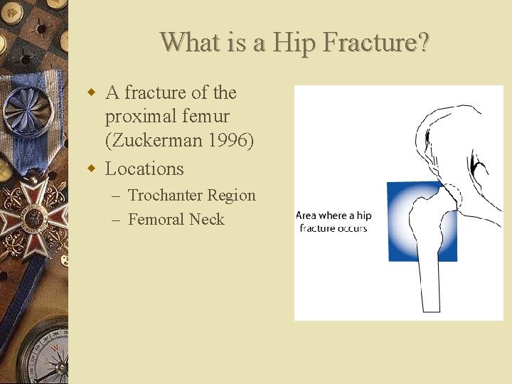 What is a Hip Fracture? w A fracture of the proximal femur (Zuckerman 1996)