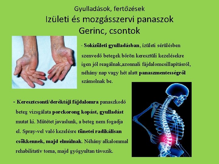 Gyulladások, fertőzések Izületi és mozgásszervi panaszok Gerinc, csontok - Sokízületi gyulladásban, ízületi sérülésben szenvedő