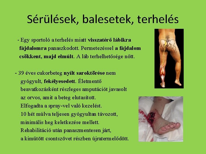 Sérülések, balesetek, terhelés - Egy sportoló a terhelés miatt visszatérő lábikra fájdalomra panaszkodott. Permetezéssel
