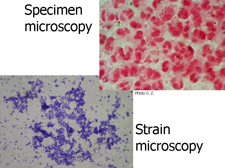 Specimen microscopy Photo O. Z. Strain microscopy 