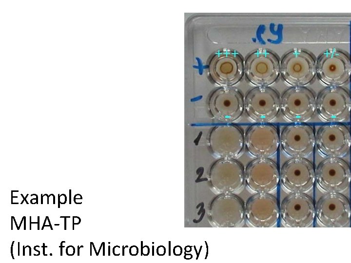 +++ ++ + +/- - Example MHA-TP (Inst. for Microbiology) - - - 