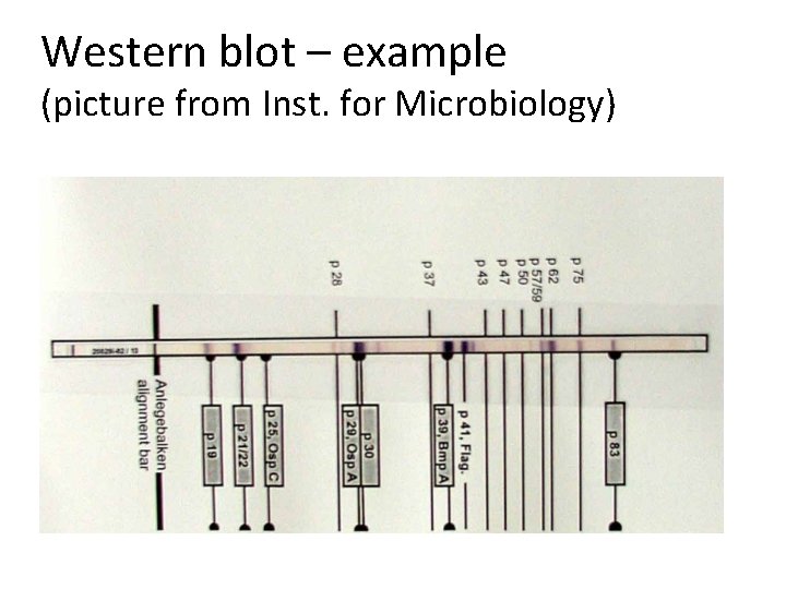 Western blot – example (picture from Inst. for Microbiology) 