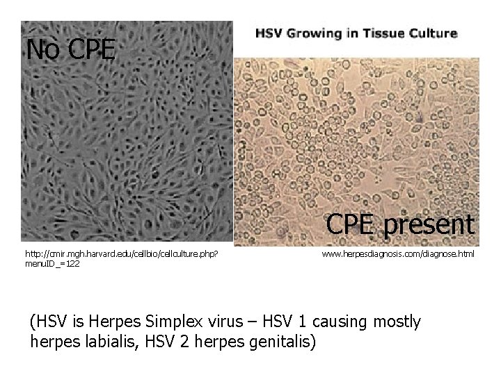 No CPE present http: //cmir. mgh. harvard. edu/cellbio/cellculture. php? menu. ID_=122 www. herpesdiagnosis. com/diagnose.