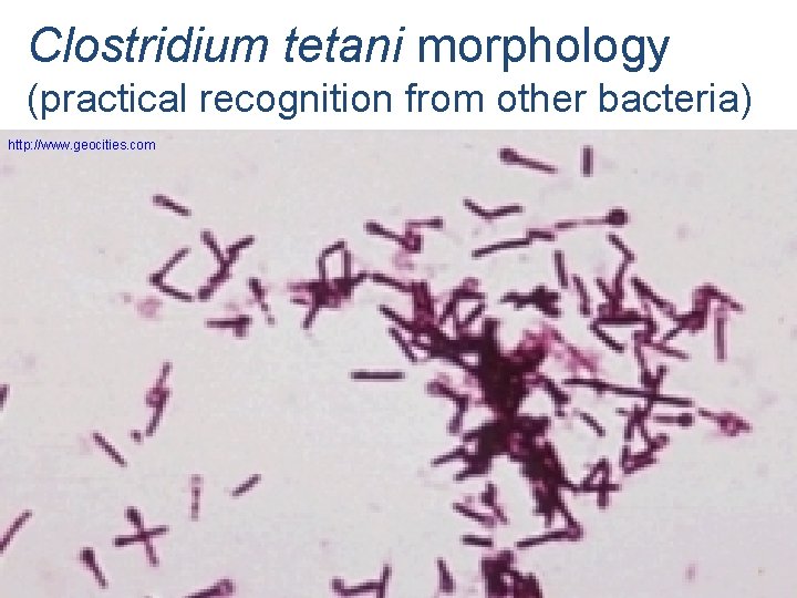 Clostridium tetani morphology (practical recognition from other bacteria) http: //www. geocities. com 