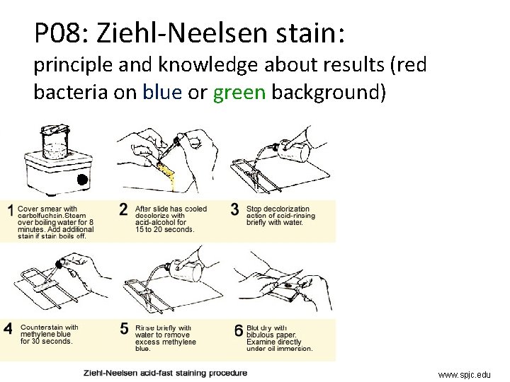 P 08: Ziehl-Neelsen stain: principle and knowledge about results (red bacteria on blue or