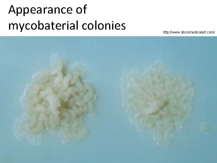 Appearance of mycobaterial colonies http: //www. stockmedicalart. com/ 