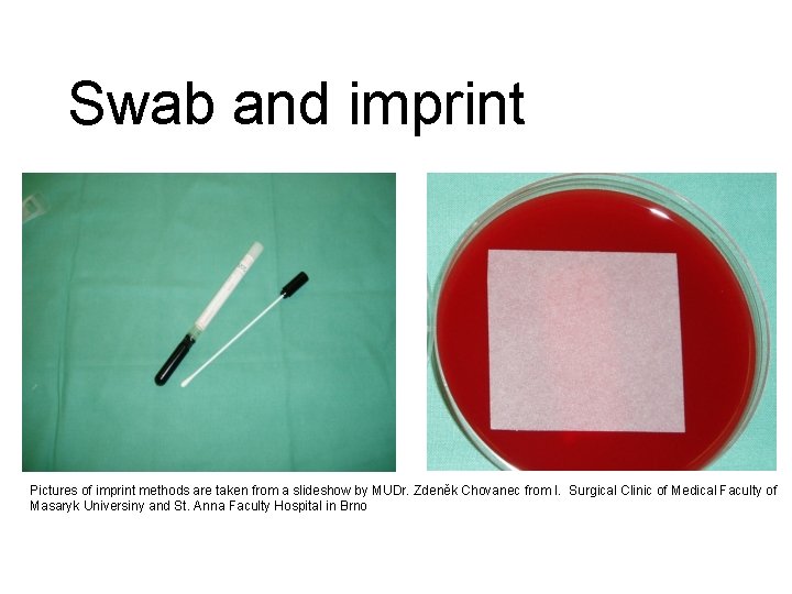 Swab and imprint Pictures of imprint methods are taken from a slideshow by MUDr.