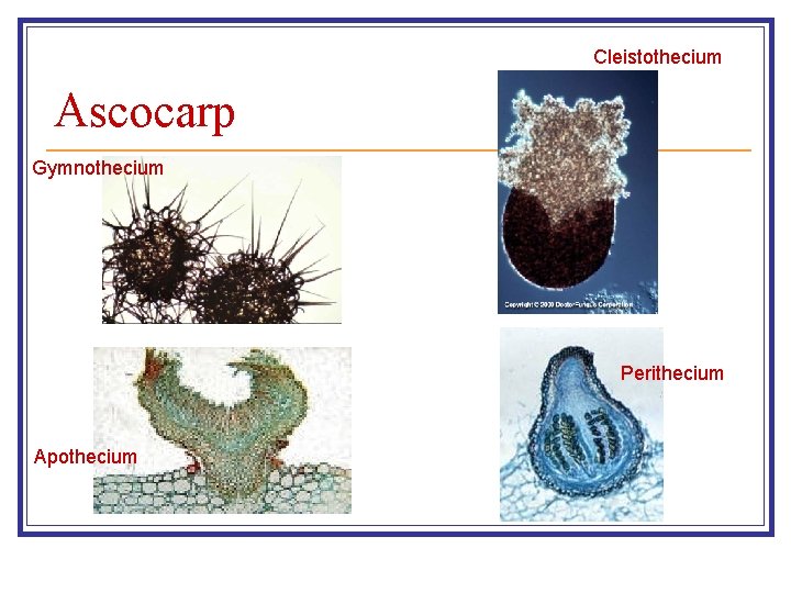 Cleistothecium Ascocarp Gymnothecium Perithecium Apothecium 