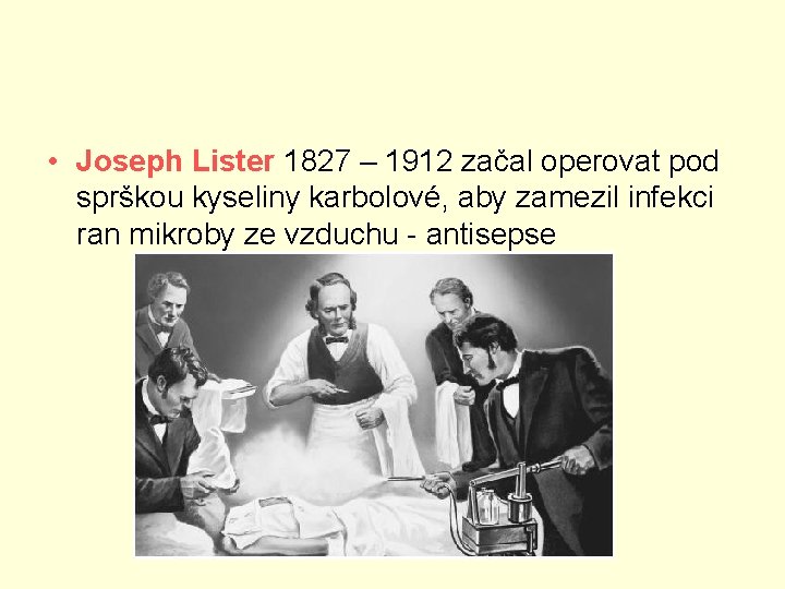  • Joseph Lister 1827 – 1912 začal operovat pod sprškou kyseliny karbolové, aby