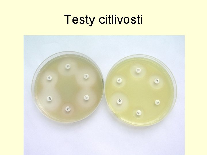 Testy citlivosti 