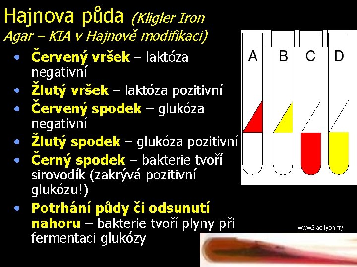 Hajnova půda (Kligler Iron Agar – KIA v Hajnově modifikaci) • Červený vršek –