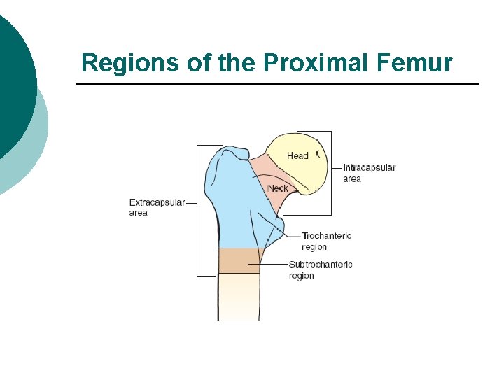 Regions of the Proximal Femur 