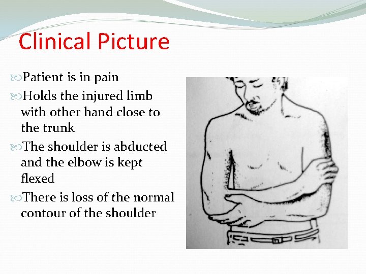 Clinical Picture Patient is in pain Holds the injured limb with other hand close