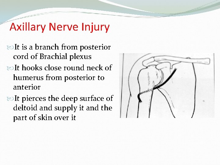 Axillary Nerve Injury It is a branch from posterior cord of Brachial plexus It