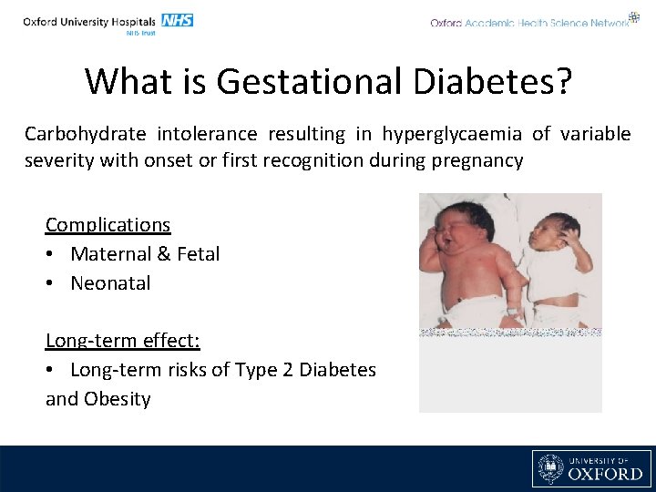 What is Gestational Diabetes? Carbohydrate intolerance resulting in hyperglycaemia of variable severity with onset