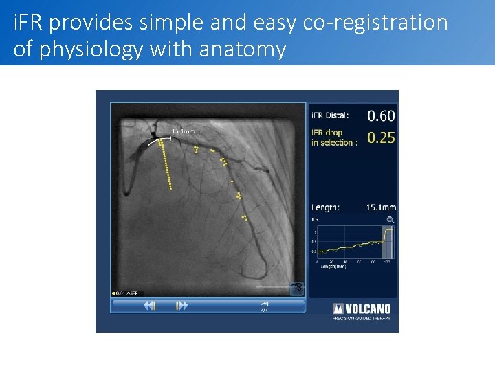 i. FR provides simple and easy co-registration of physiology with anatomy 