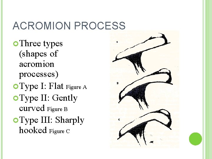 ACROMION PROCESS Three types (shapes of acromion processes) Type I: Flat Figure A Type