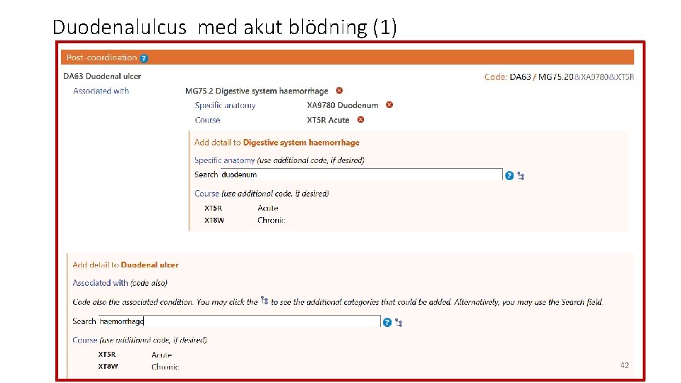 Duodenalulcus med akut blödning (1) 42 