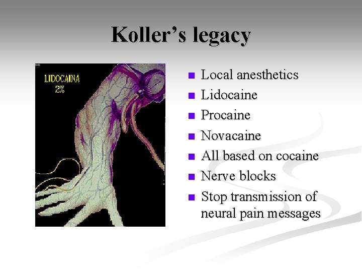 Koller’s legacy n n n n Local anesthetics Lidocaine Procaine Novacaine All based on