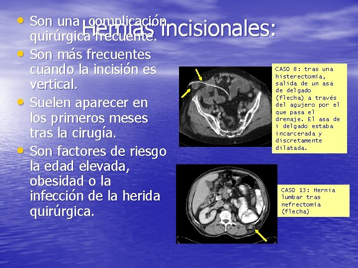  • Son una complicación • • • Hernias incisionales: quirúrgica frecuente. Son más