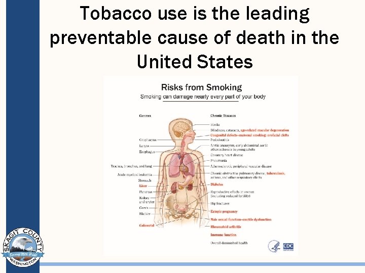 Tobacco use is the leading preventable cause of death in the United States 