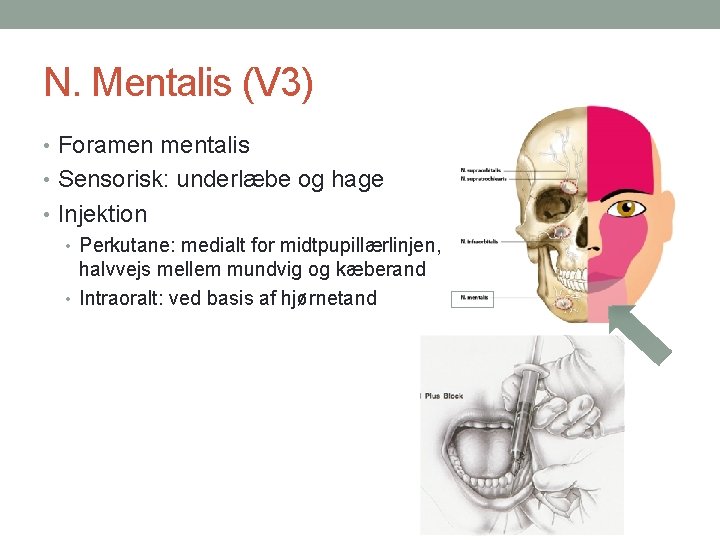 N. Mentalis (V 3) • Foramen mentalis • Sensorisk: underlæbe og hage • Injektion