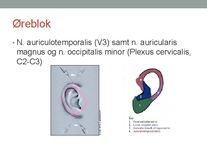Øreblok • N. auriculotemporalis (V 3) samt n. auricularis magnus og n. occipitalis minor