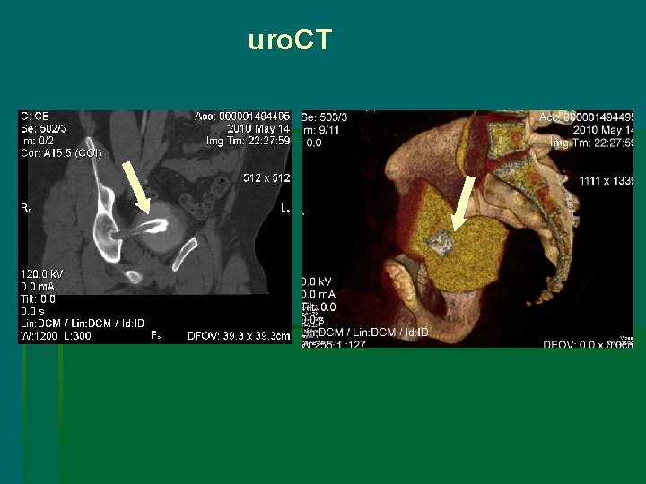  uro. CT 