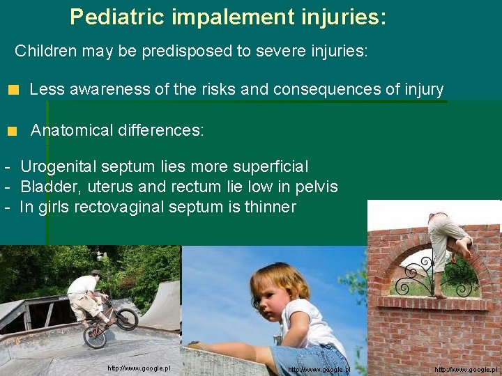 Pediatric impalement injuries: Children may be predisposed to severe injuries: Less awareness of the