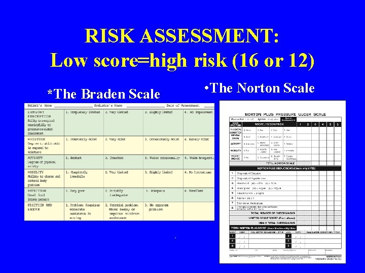 RISK ASSESSMENT: Low score=high risk (16 or 12) • The Norton Scale *The Braden