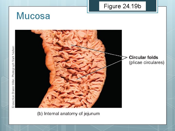 Figure 24. 19 b Mucosa 