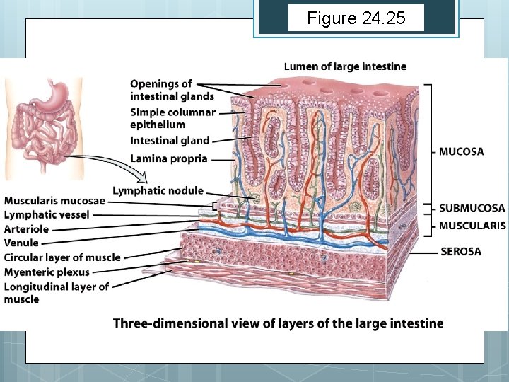 Figure 24. 25 Figure 24. 25