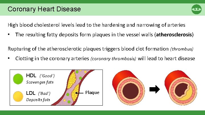 Coronary Heart Disease High blood cholesterol levels lead to the hardening and narrowing of
