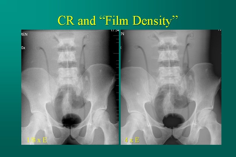 CR and “Film Density” 1/8 x E 4 x. E 