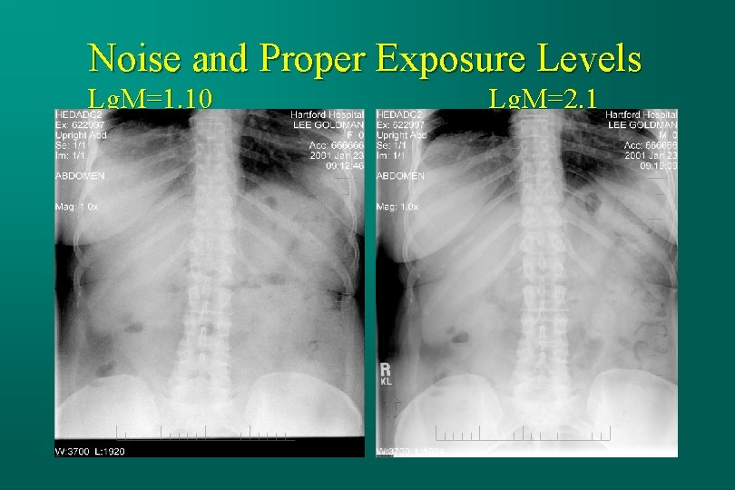 Noise and Proper Exposure Levels Lg. M=1. 10 Lg. M=2. 1 