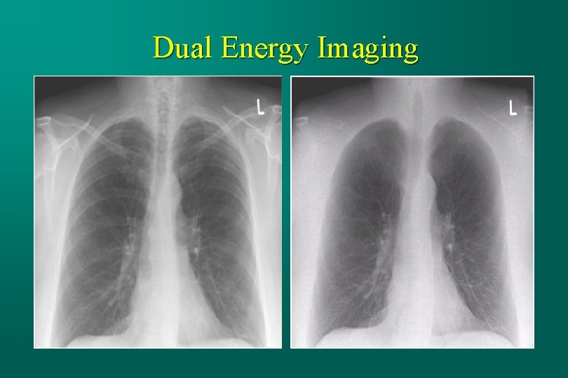 Dual Energy Imaging 